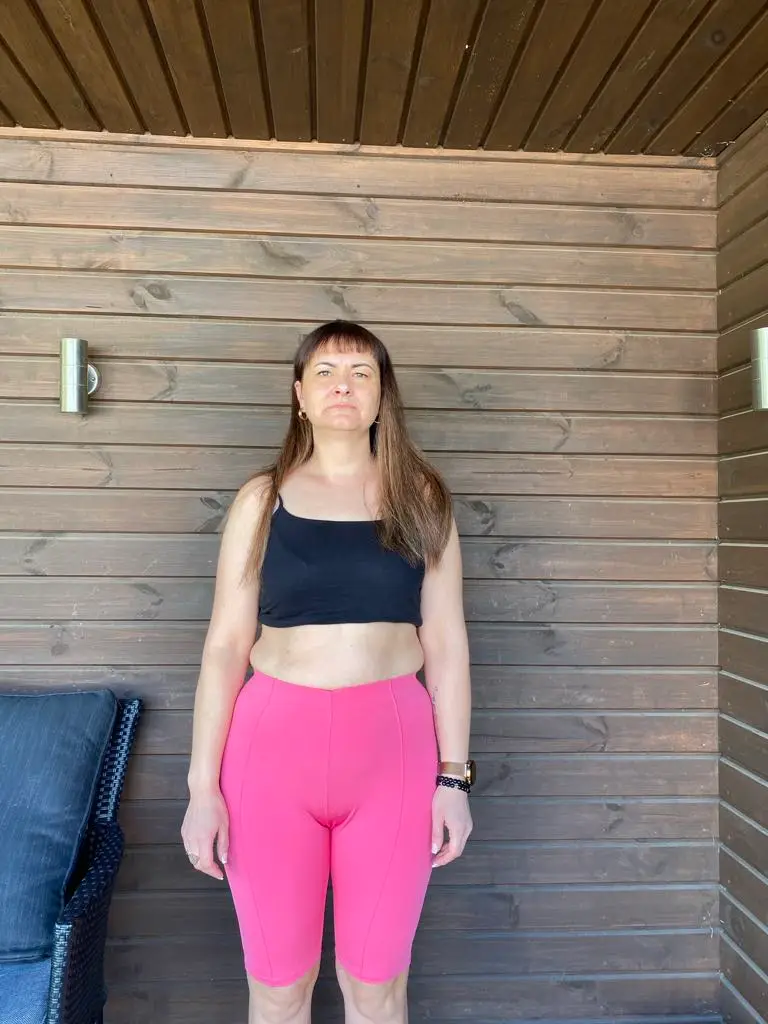 JOLITA VARNAGIRIENĖ transformacijos foto prieš